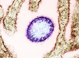 Nipah Virus
