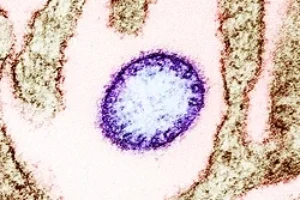 Nipah Virus