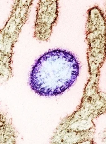 Nipah Virus