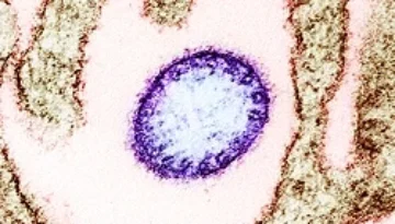 Nipah Virus