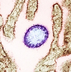 Nipah Virus